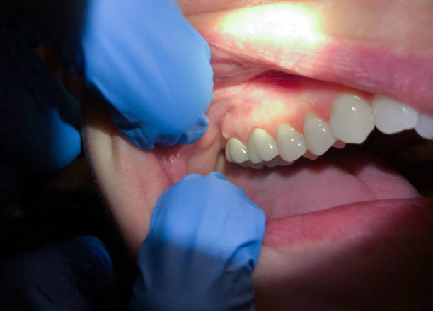 Best Emergency Cosmetic Dentistry in Lamar, TX