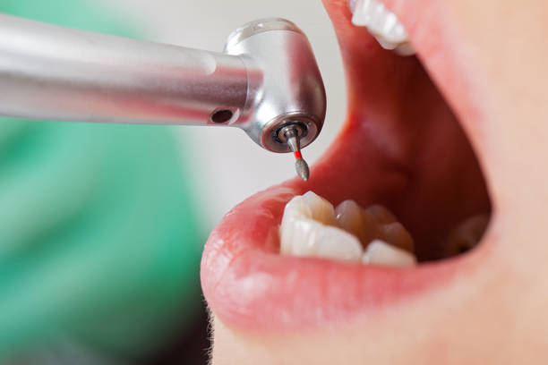 Best Pediatric Emergency Dentist in Lamar, TX